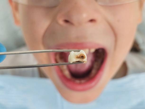 Best Emergency Treatment for Oral Infections in Lake Arrowhead, ME